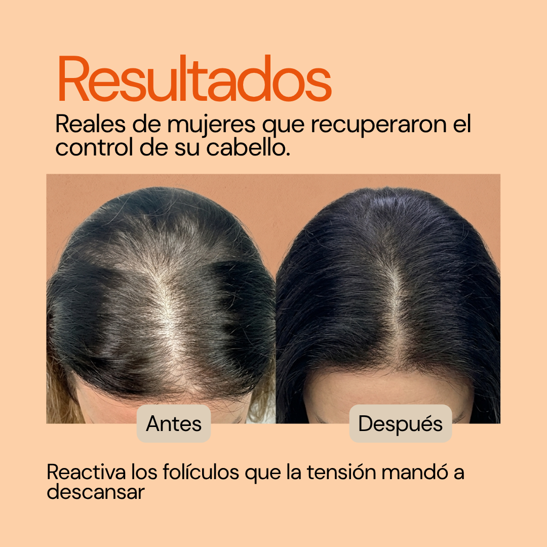 Kit Machē Reset - El ritual que restaura, purifica y renueva tu cabello desde la raíz