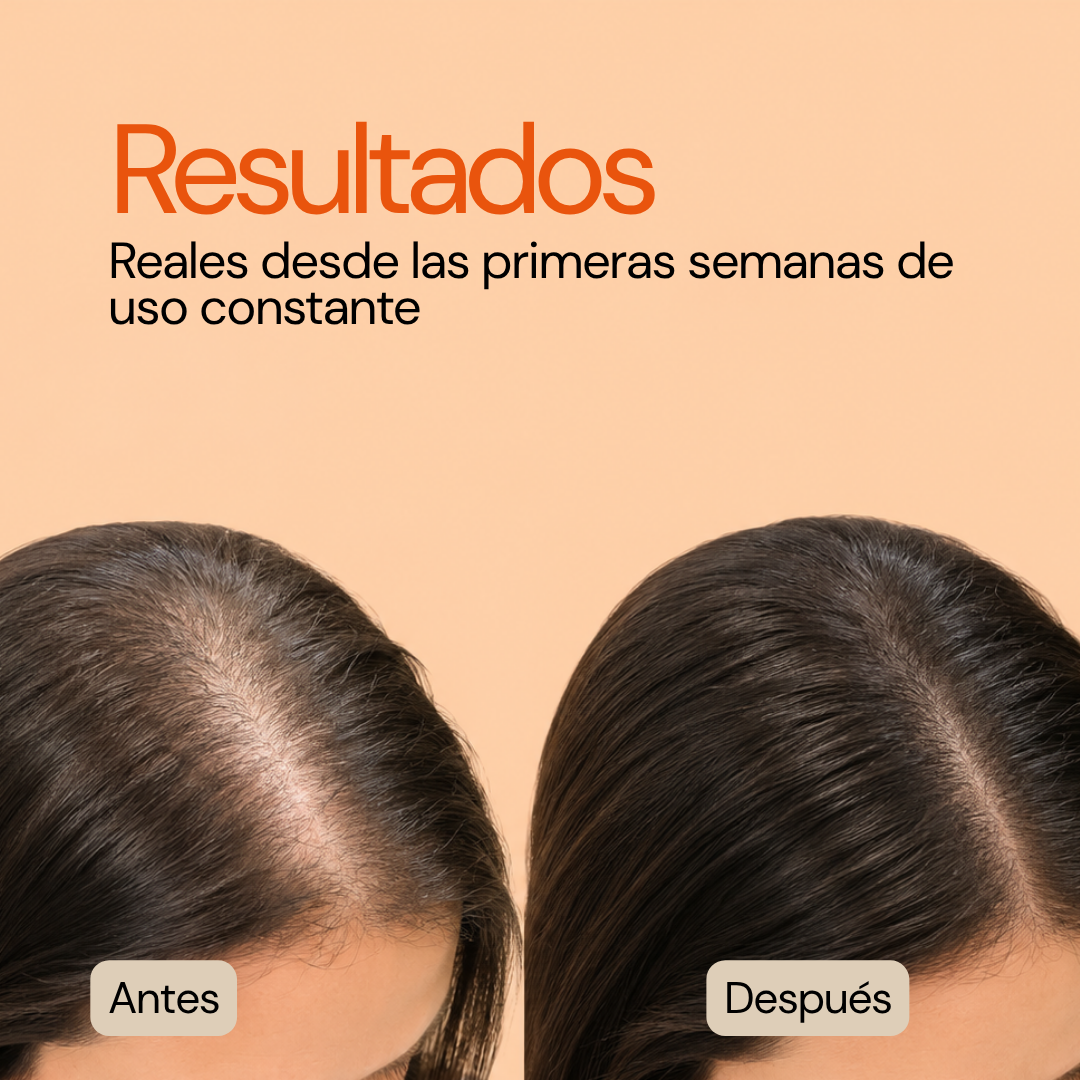 Kit Machē Full Hair Routine | Recupera la fuerza y densidad de tu cabello después del embarazo