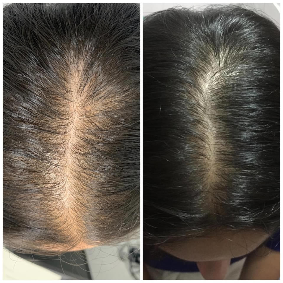 Kit Machē Full Hair Routine | El ritual que restaura, purifica y renueva tu cabello desde la raíz
