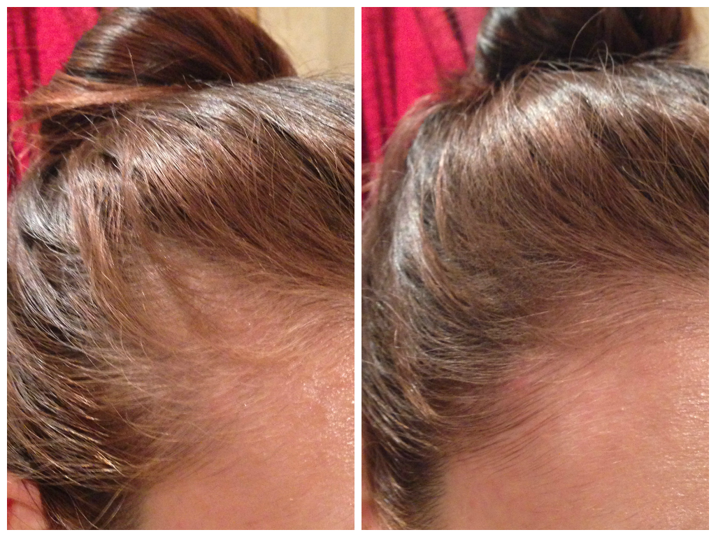 Kit Machē Reset - El ritual que restaura, purifica y renueva tu cabello desde la raíz